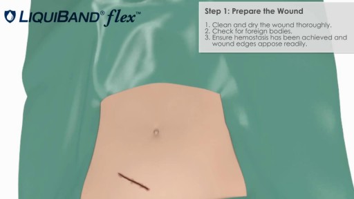 LiquiBand Flex Topical Skin Adhesive