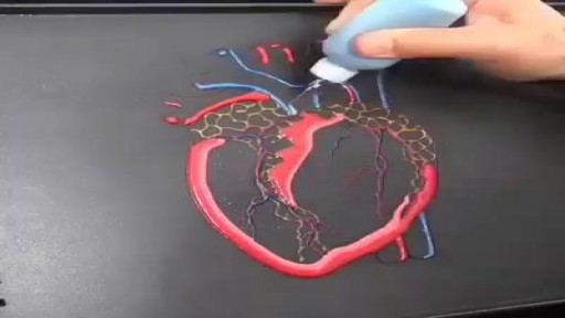 Pancake by a Cardiologist