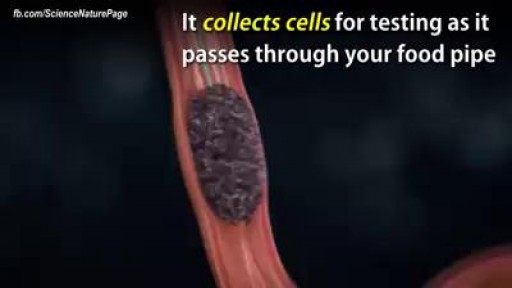 Cancer-Detecting Sponge