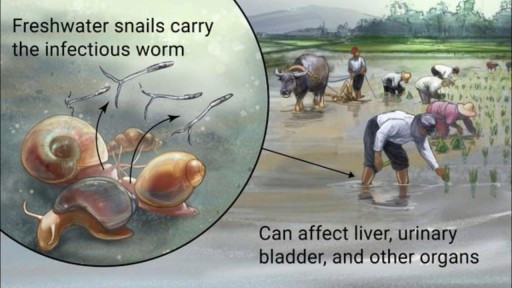 ⁣Schistosomiasis Causes Symptoms and Treatment of