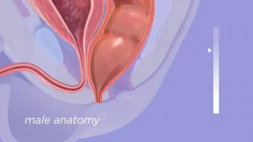 ⁣Anorectal Malformation