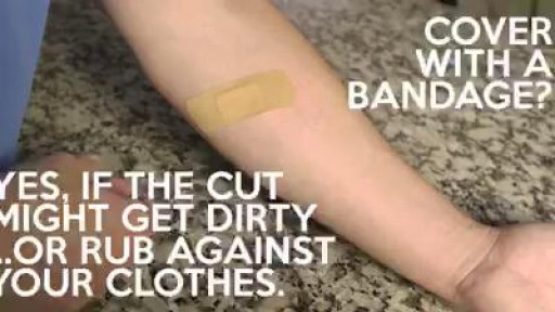 Most minor cuts you can treat yourself