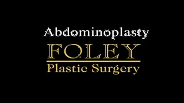 Abdominoplasty