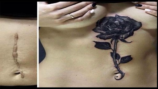 ⁣Amazing Tattoos of Scars