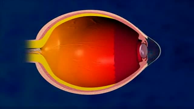 3D Lasik Eye Surgery Animation