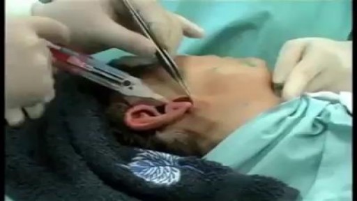 Facial Plastic Surgery