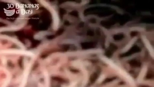 ⁣Bodybuilder's Colon Contains 10 lbs Meat Worms