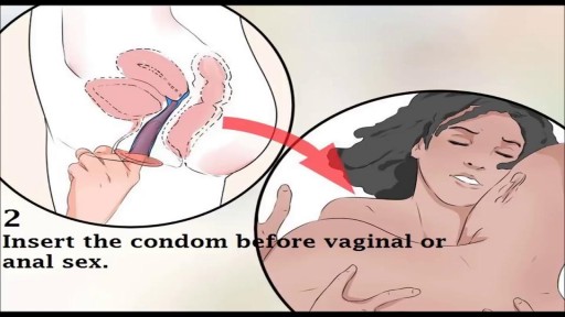 ⁣Medical Videos - How to Use Female Condom