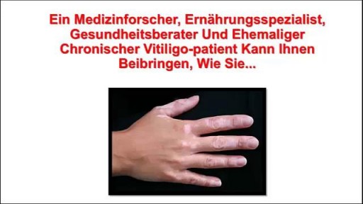 ⁣Weiße Punkte Auf Der Haut, Vitiligo Symptome, Vitiligo Behandlung, Weiße Flecken Haut Pilz