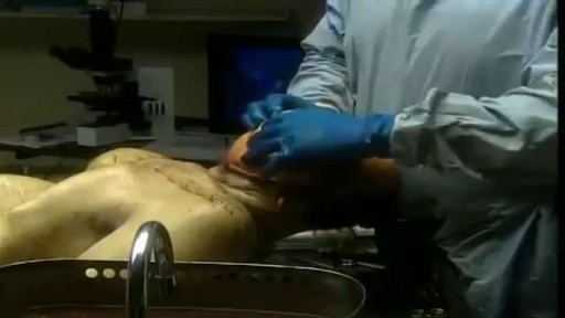 Medical Videos - Human Body Medical Autopsy for Poison