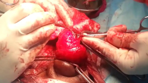 ⁣Medical Videos - Broken Male Genital Repairing Surgery