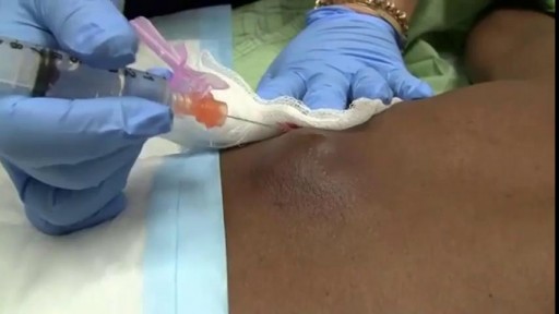 ⁣Popping a big Abscess in the ER