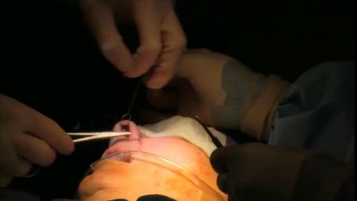 ⁣Nose Surgery Reconstruction