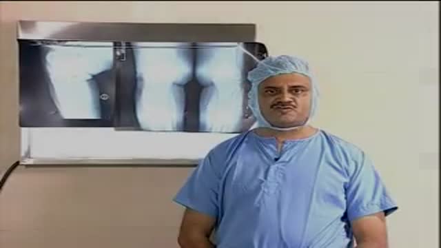 Knee replacement procedure video