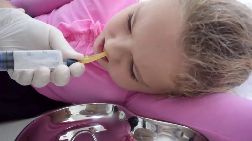 Treatment of sinusitis in children