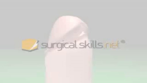 ⁣Circumcision Video 3D