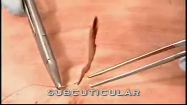 Subcuticular Skin Suturing