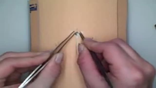 Staples Insertion and Removal