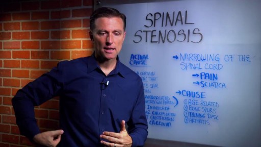 ⁣What is the Spinal Stenosis?