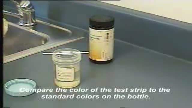 ⁣Testing Urine for Protein and Glucose by Dip Stick