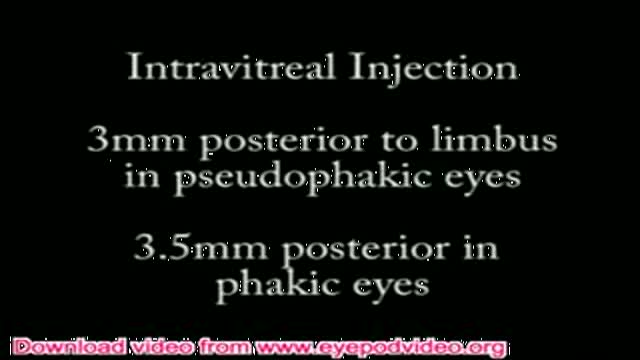 Intravitreal Injection Technique