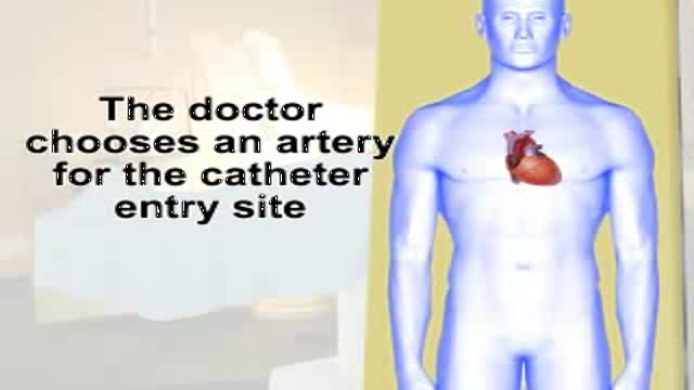 Cardiac Catheterization Video