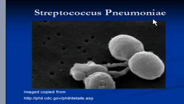 ⁣Pneumonia -Streptococcal pneumonia