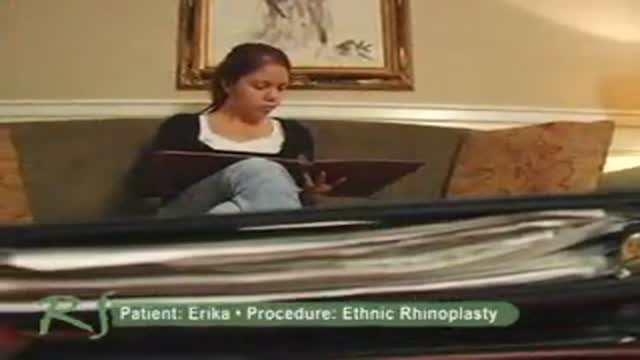 Patient Experience Having Ethnic Rhinoplasty Performed by Dr. Paul S. Nassif