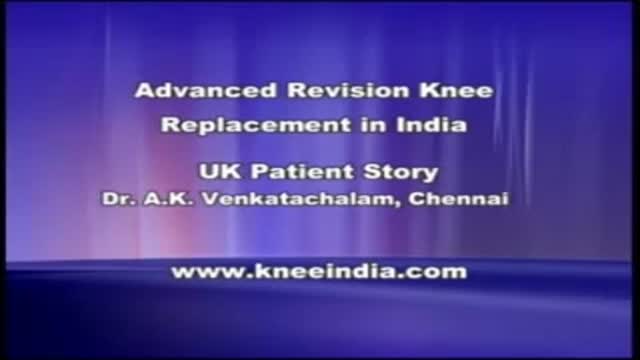 Revision knee Replacement part 1 Video