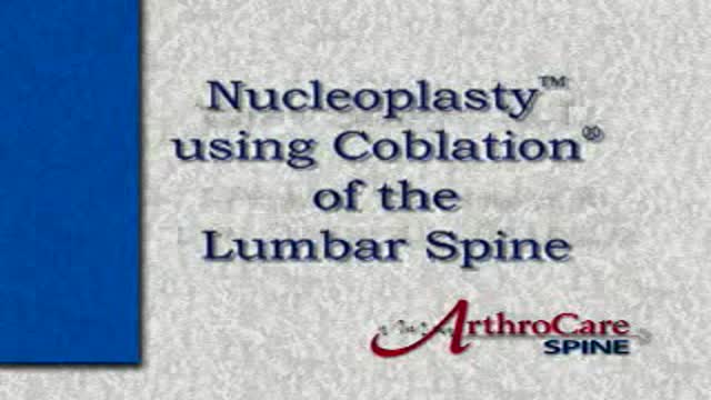 ⁣Nucleoplasty using Coblation of the Lumbar Spine