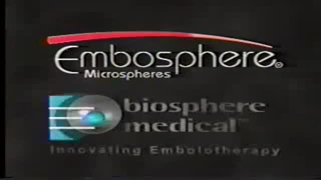 ⁣Embospheres Microspheres as a choice in Embolization