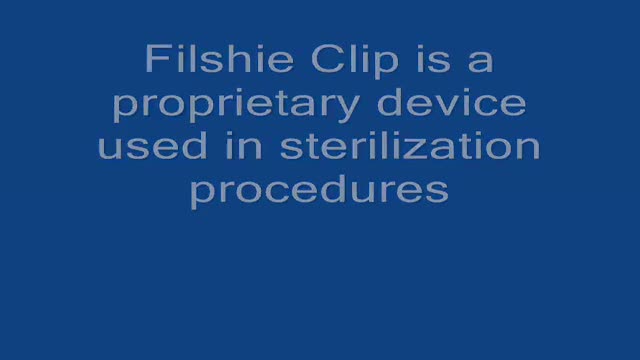 ⁣Laparoscopic Tubal Ligation with Filshie clip
