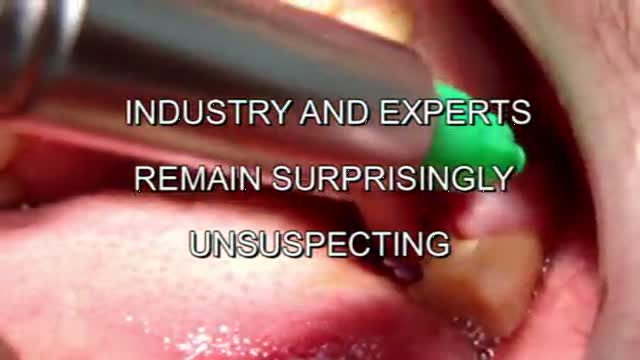  LIVE VIDEO:  IMMEDIATE ANATOMIC CERAMIC IMPLANT IN 3 MINUTES!