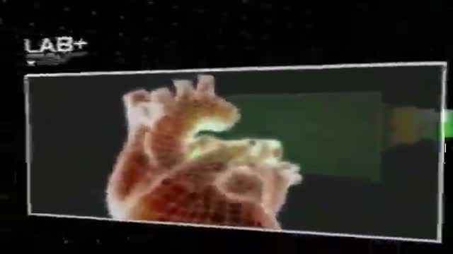 ⁣Animated Clip shows how stem cells work for heart : Vescell