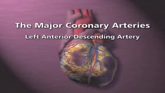 ⁣Overview of Coronary Artery Disease - Animation 3D