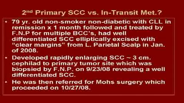 Scalp Squamous Cell Carcinoma  / Surgery Video Vignettes