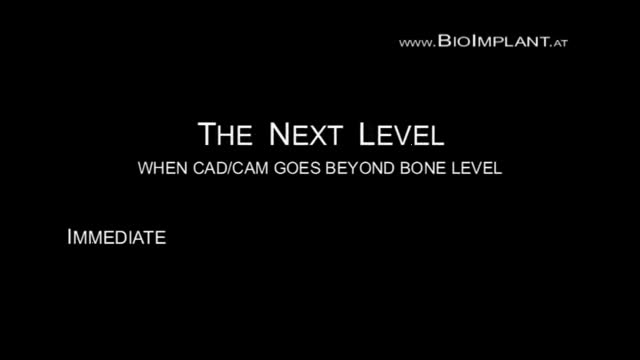 WORLD`S BEST IMMEDIATE ZIRCONIA DENTAL IMPLANT SOLUTION