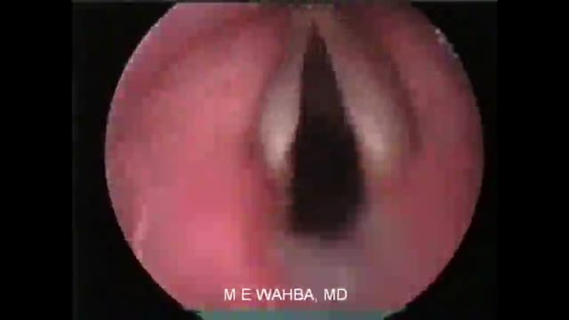 ⁣Vocal cords in Action