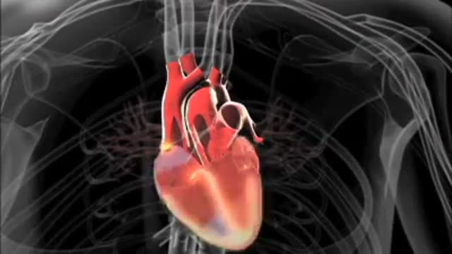 Getting to the Heart of Stroke Disease
