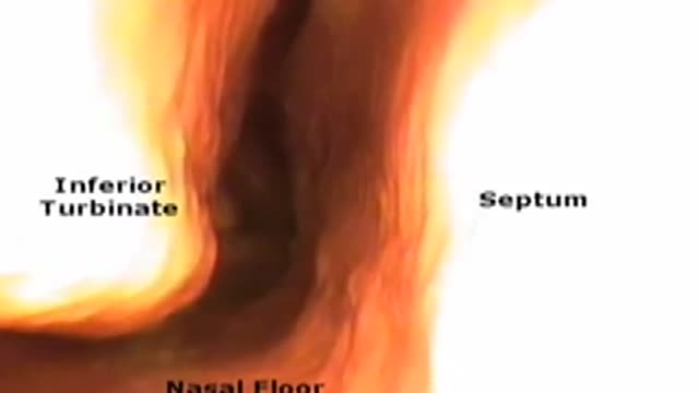 ⁣Anatomy Tutorial During Trans Nasal Endoscopy