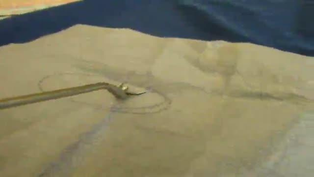 Laparoscopic Vaginal Top Closure Operation