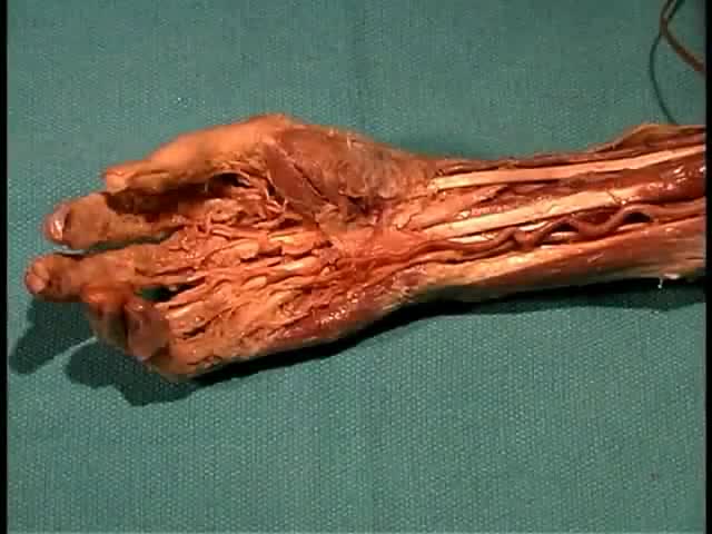 ⁣Anatomy of The Forearm and Hand