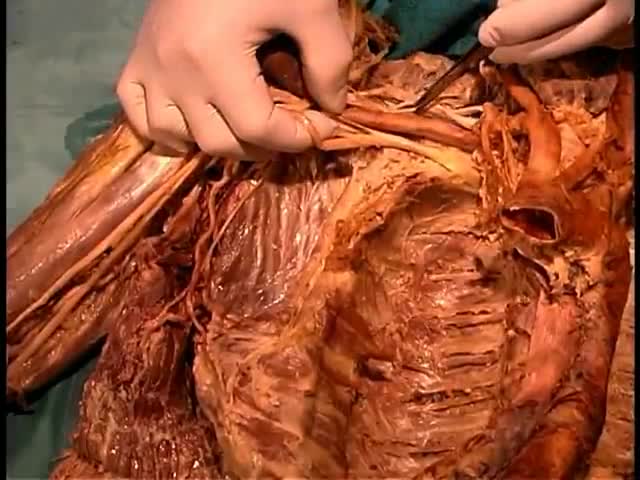 Anatomy of The Axillary Fossa