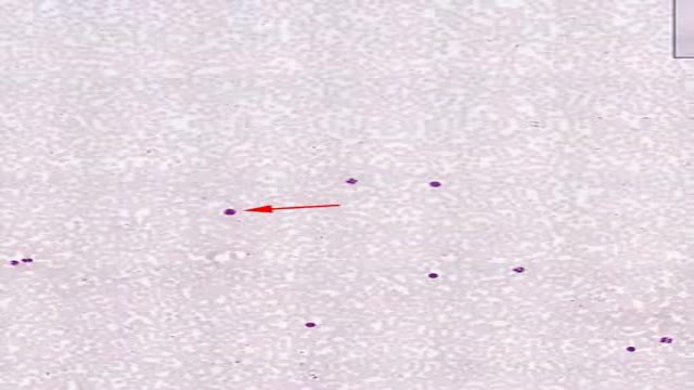 ⁣Histology of Blood Smear