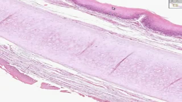 Histology of Epiglottis