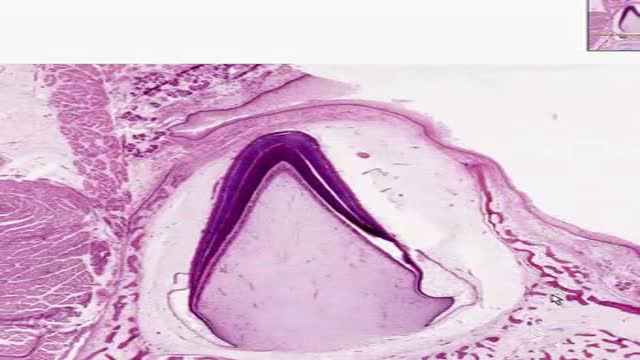 Histology of Tooth Eruption