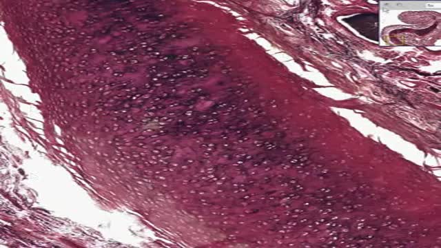 ⁣Histology of Elastic Cartilage