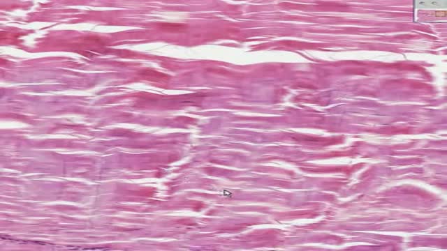 Histology of Dense Regular Connective Tissue