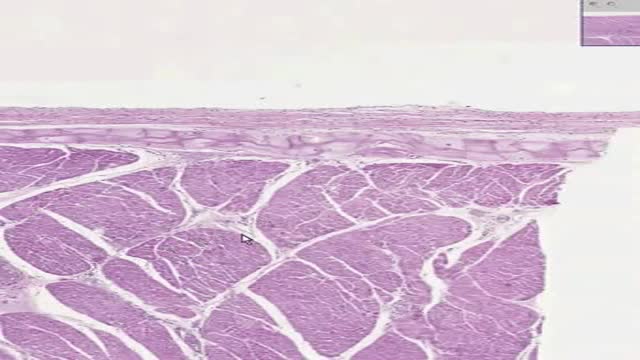 Histology of Heart Purkinje Fibers