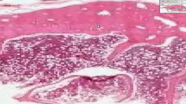 Histology of Spongy Bone